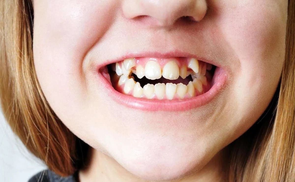 Before dental treatment